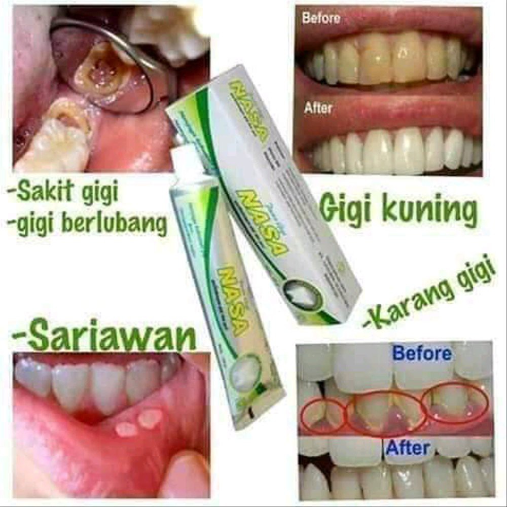 [ORI] PASTA GIGI ANTI BAKTERI MULUT DAN GUSI 24 JAM MELINDUNGI | NASA COMPLETE MOUTH CARE