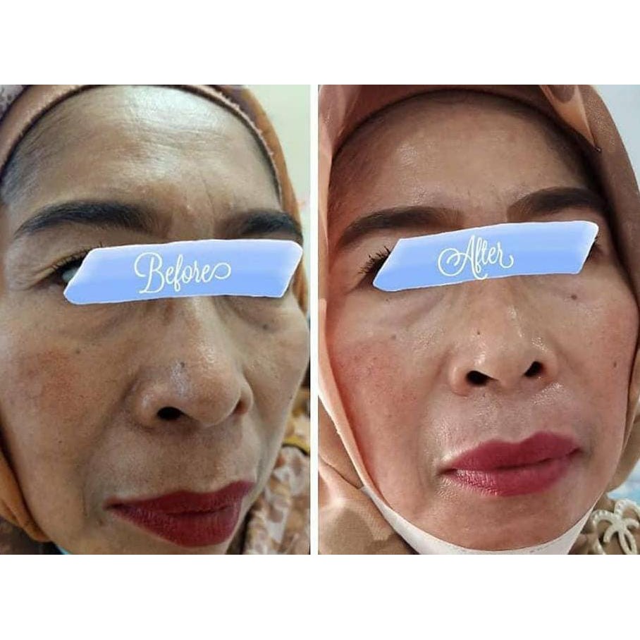 CREAM PENCERAH WAJAH KRIM PEMUTIH WAJAH PENGHILANG FLEK JERAWAT - CB CREAM KOREA ORIGINAL