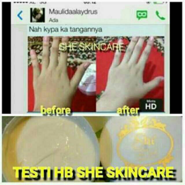 Lotion HB SUPER INDO FARMA urutan 9 lebih keras whitening racik chemical ORIGINAL bahan murni pemuti