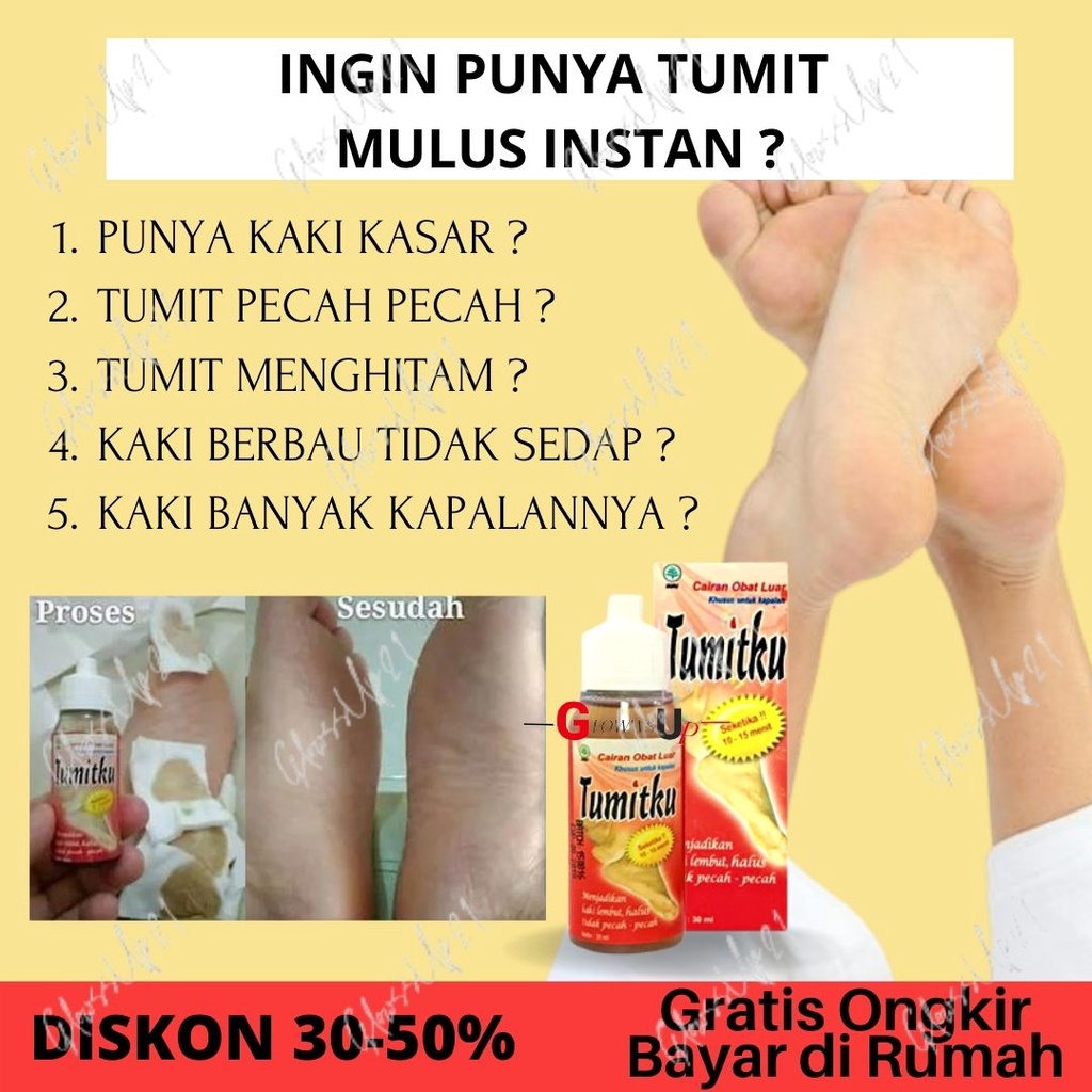 TUMITKU OBAT KAKI PECAH TUMITKU 30ML OBAT HERBAL MENGATASI KAKI PECAH PECAH 30ML ORIGINAL BPOM