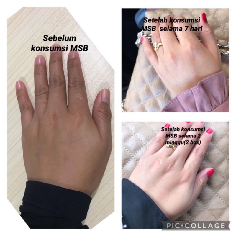 

KOLAGEN MELACCA SKIN BOOSTER || BELI 2 FREE SABUN MELACCA