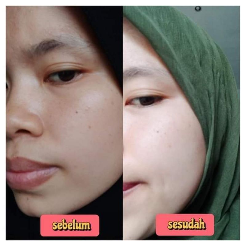 PAKET MORESKIN NATURE NASA/ SERUM/ NIGHT & DAY CREAM/ TONER/ FACIAL FOAM/ SKINCARE/ ANTI ACNE/ JERAW