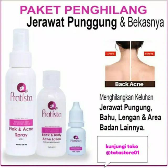 Paket Obat Jerawat Punggung Badan Atau Dada Pratista Ampuh