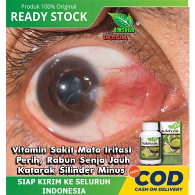 Keloreena Kapsul Berkhasiat Untuk Vitamin Sakit Mata Iritasi, Perih, Rabun Senja Jauh, Katarak, Obat