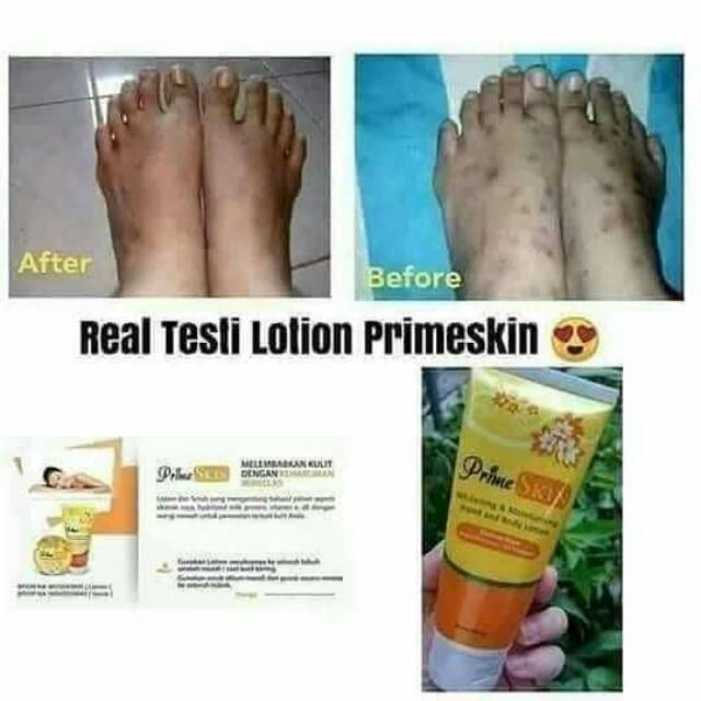 Prime skin lotion menghilangkan bekas luka menghaluskan kulit mengandung soya