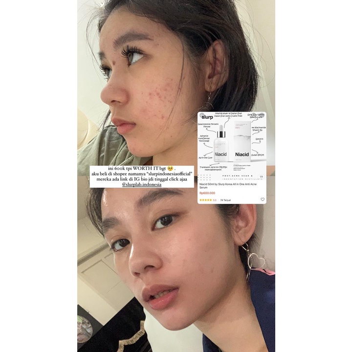 Niacid by Slurp Laboratories Korea All in One Face Serum BPOM Approved Bergaransi Asli-3
