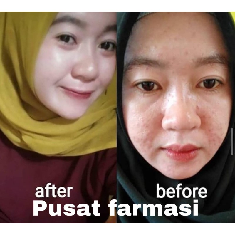 PAKET WHITENING WAJAH | PAKET USAHA