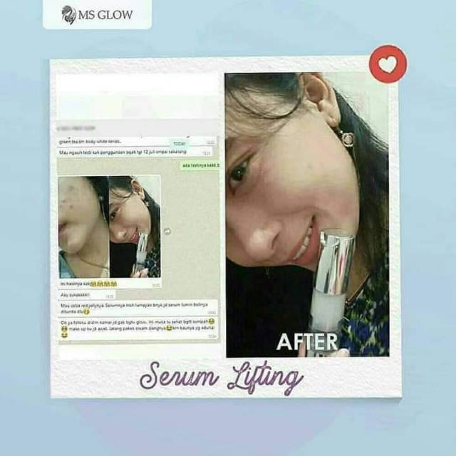 MS GLOW Serum Lifting GLow (untuk mengencangkan kuLit wajah)