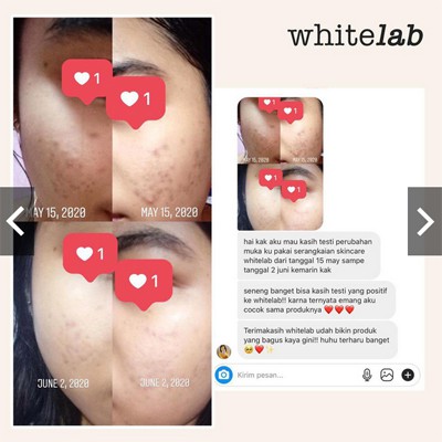 [5 pcs ] ORIGINAL 100% Whitelab Brightening Paket Wajah LENGKAP