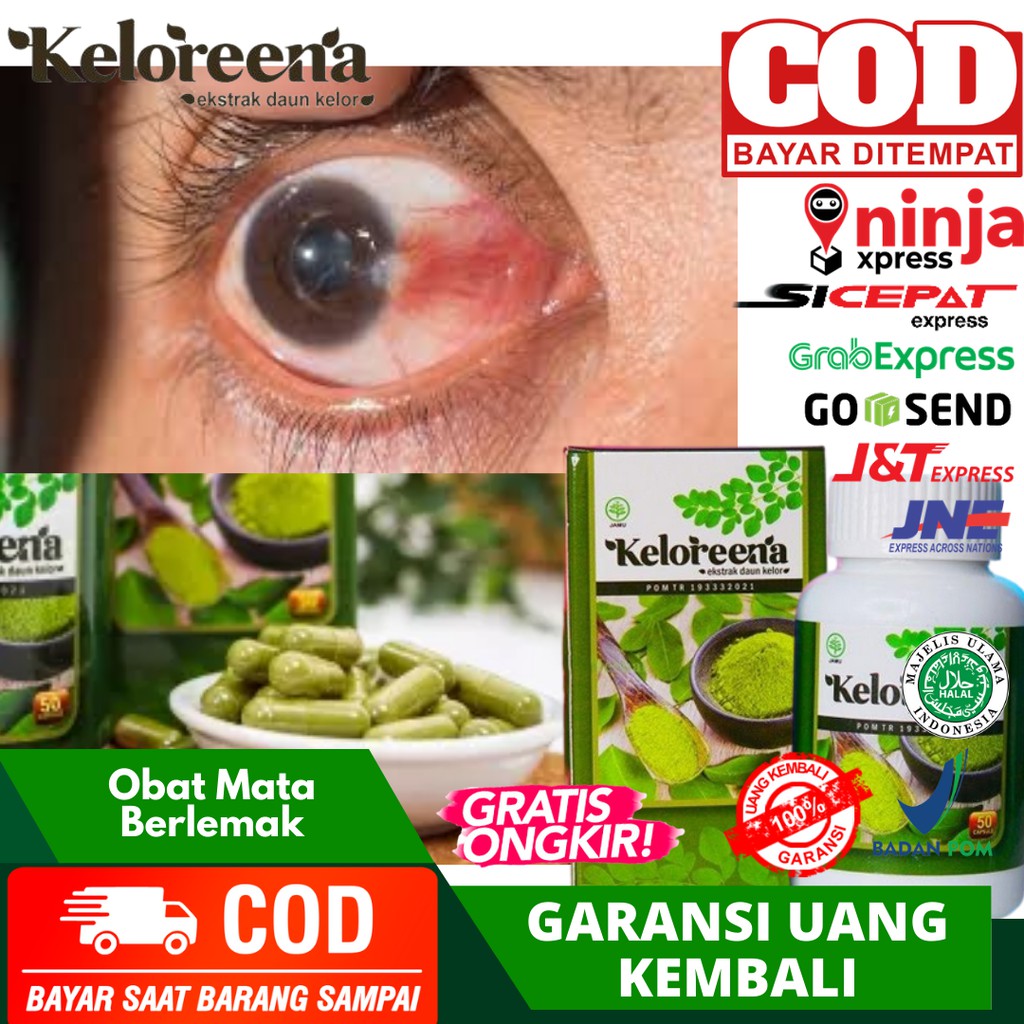 Obat Mata Berlemak Penghilang Lemak Di Mata Pterygium Keloreena Daun Kelor Asli 100 Alami Indonesia