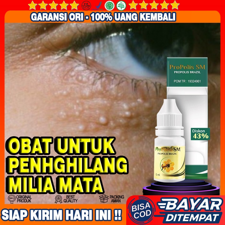 Obat Milia Di Bawah Mata, Milia Pada Wajah, Milia Di Mata, Milia Di Kelopak Mata, Penghilang Milia