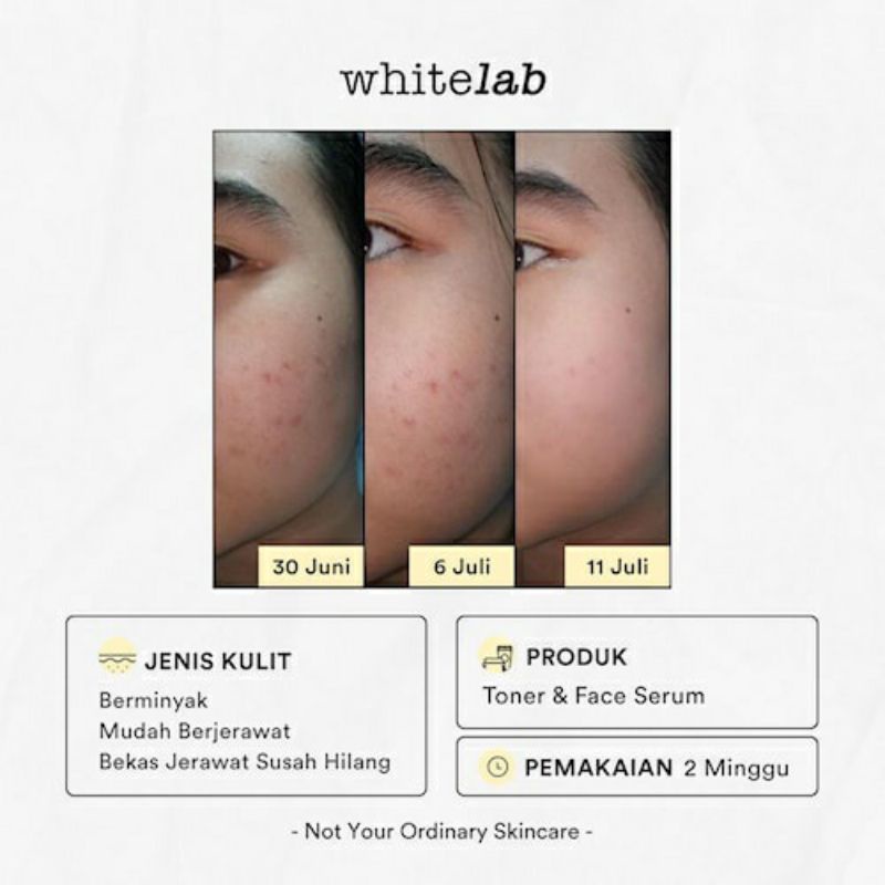 Whitelab Brightening Face Toner 100mL