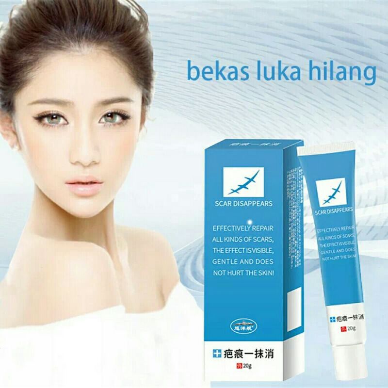 Cream penghilang bekas luka kering