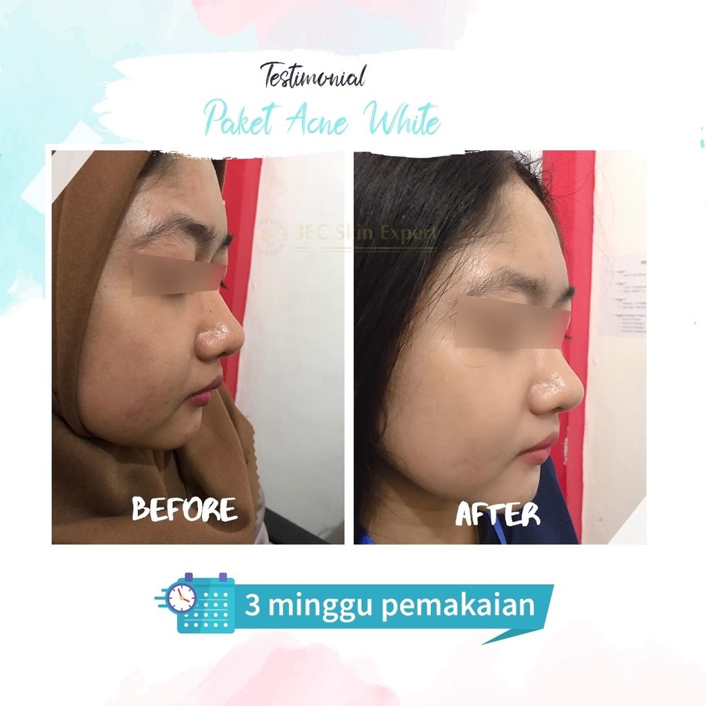 BEC Skin Expert -  Paket Wajah Treatment Series-7