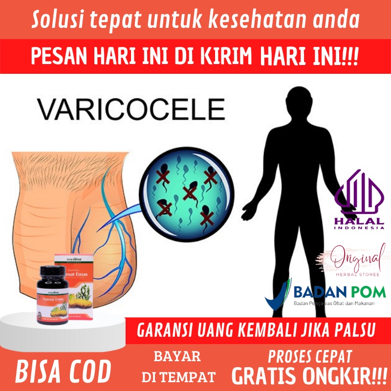 Obat Hidrokel Alami, Obat Testis Bengkak / Sakit testis, Obat testis Nyeri, Obat Buah Zakar besar se