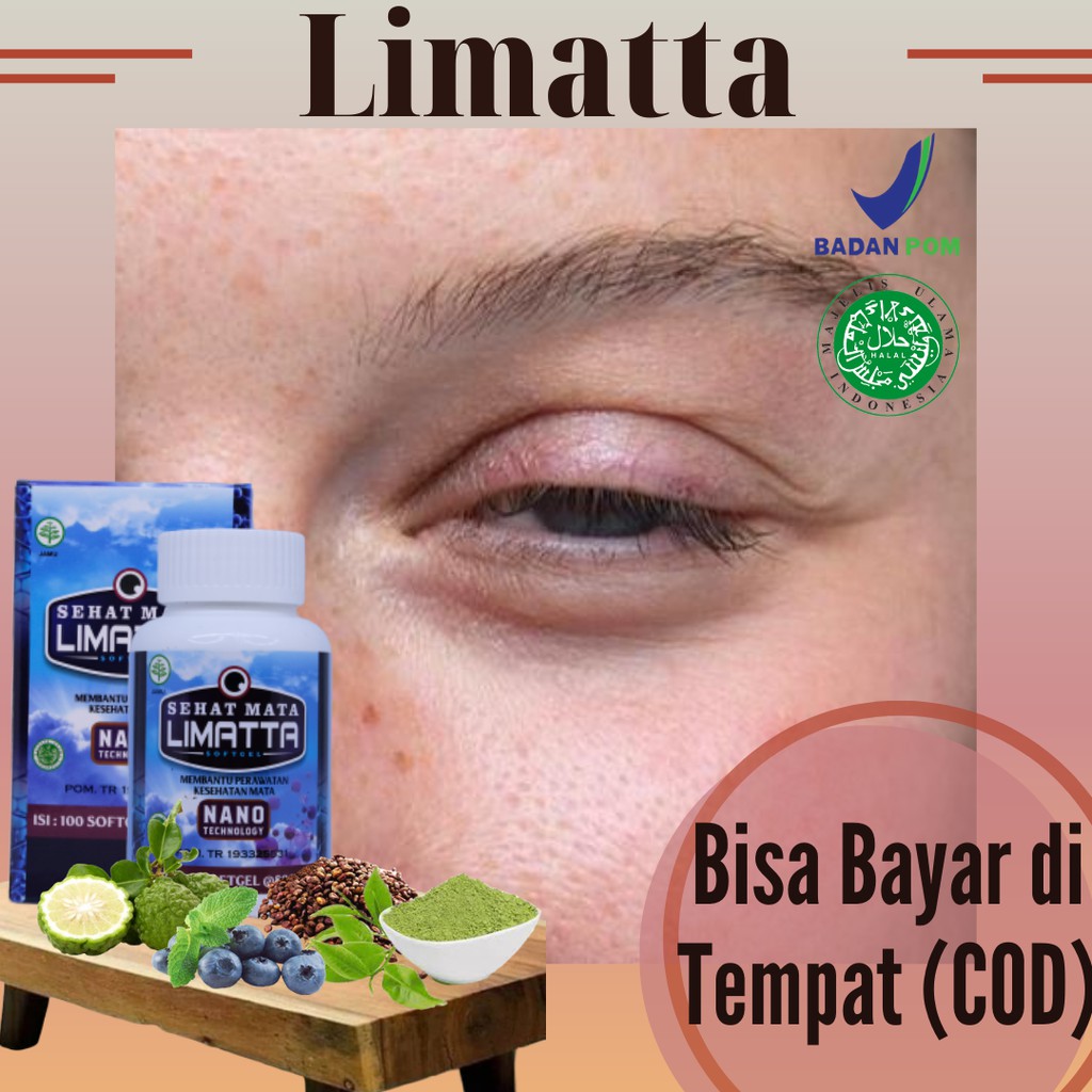 Jual Obat Saraf Mata Lemah Kerusakan Saraf Mata Optik Pembengkakan