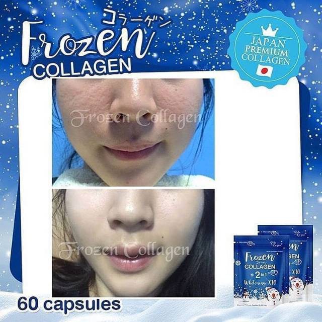 Frozen COllagen 60 Capsule Original