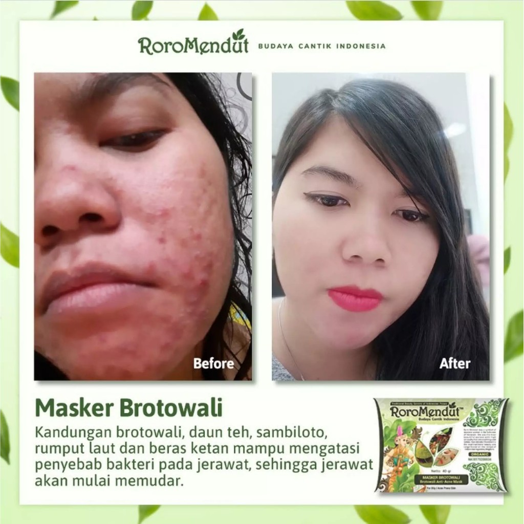 Roro Mendut Masker Brotowali Anti Acne / Jerawat / Komedo Organik / Herbal 20gr &amp; 40gr