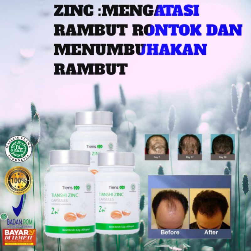 [TERLARIS]COD ZINC||PENYEHAT RAMBUT TERBAIK DI DUNIA||PENUMBUH BULU TERBAIK DI DUNIA||PENUMBUH RAMBU