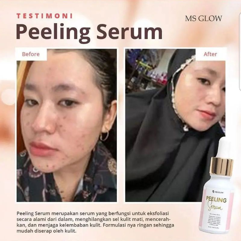 PEELING SERUM 10 ML MS GLOW BARKODE BPOM.