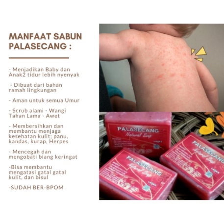 ✰BIG SALE✰ SABUN HERBAL PALASECANG (BIANG KERINGAT) SABUN BIANG KERINGAN  (Sabun Gatal & Biang Kerin