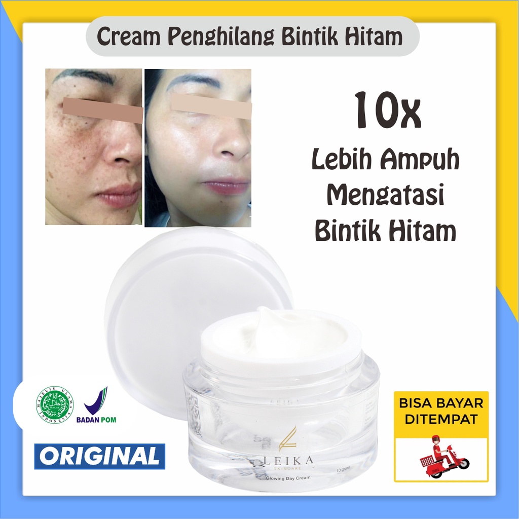Cream Penghilang Bintik Hitam Di Wajah Krim Untuk Bintik Hitam Perawatan Menghilangkan Flek dan Bint