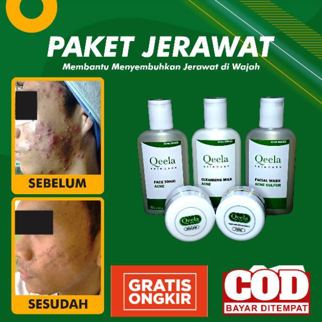 Paket Qeela Skincare Acne / Perawatan Kulit Berjerawat Pria & Wanita / Krim Jerawat Membandel