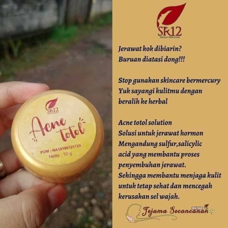 

ACNE TOTOL // HEMPASKAN JERAWAT HORMONAL