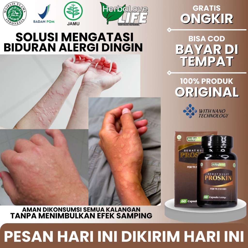 Jual Obat Biduran Gatal Alergi Dingin Menahun Obat Gatal Seluruh Badan