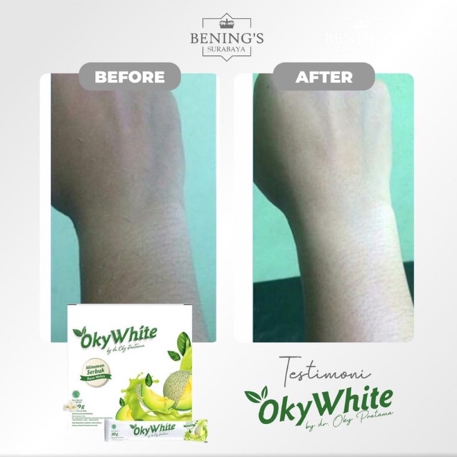 BENING'S OKYWHITE | MEMUTIHKAN &amp; MENCERAHKAN KULIT | BPOM &amp; HALAL | FREE GIFT SIAP KIRIM SELURUH INDONESIA