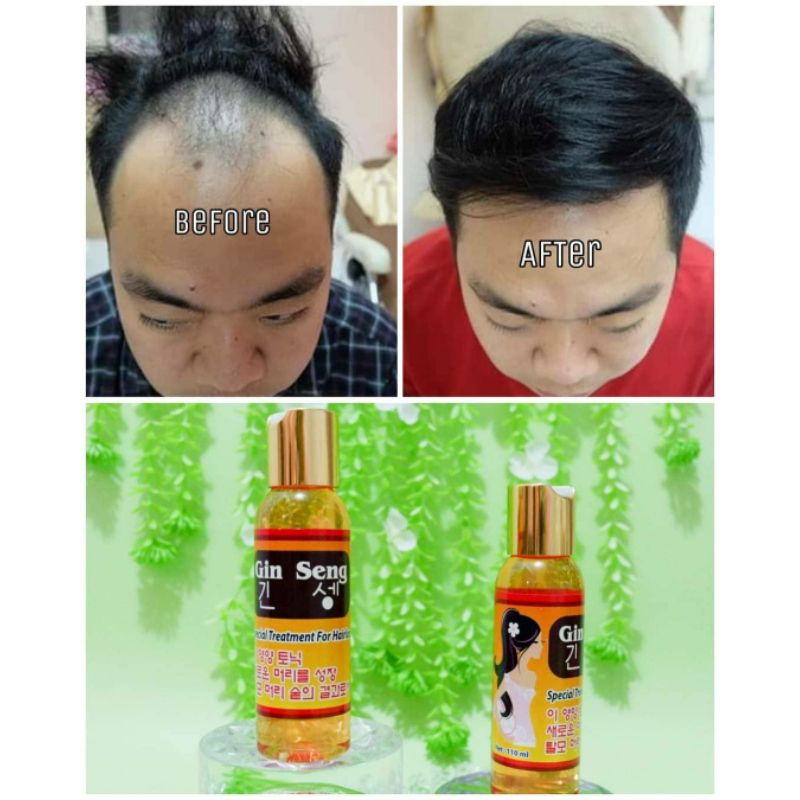 Hair Tonic Red Ginseng Korea Penumbuh Rambut