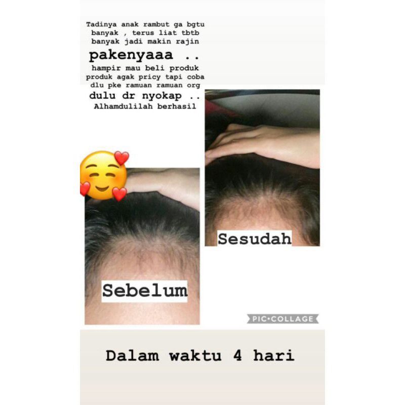 Minyak Kemiri original/minyak kemiri bayi/minyak kemiri rambut/minyak kemiri asli/penyubur rambut