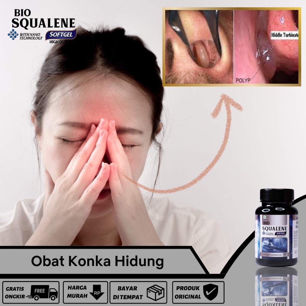 Obat Konka Hidung bengkak, Obat Hidung Tersumbat, Obat Hipertrofi konka, Obat Konka Polipoid, Obat K