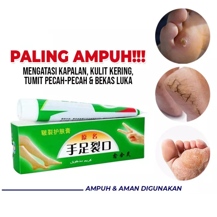 BEAUTY JAYA - [BISACOD]  Obat Salep tumit kaki kering, tebal dan pecah&quot; ampuh 100%