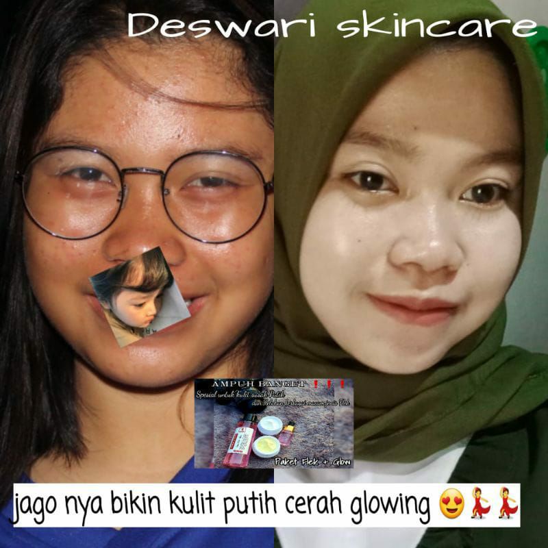 paket flek deswari skincare