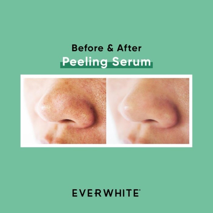 Everwhite AHA BHA PHA Peeling Serum-BPOM