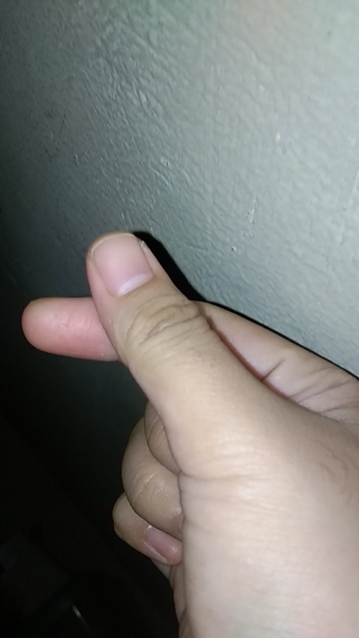 Upgrade Karet Keliling