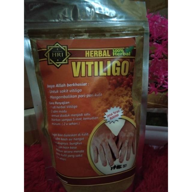 Obat Vitiligo Paling Berkhasiat Obat Untuk Vitiligo Obat Kulit Belang Obat Warna Kulit Memudar Obat Herbal