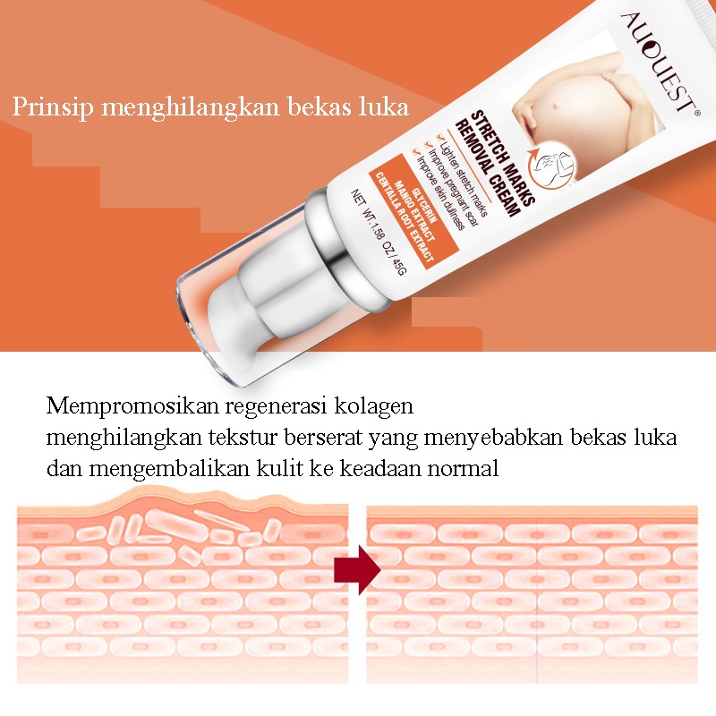 Stretch Mark Cream 45g / Penghilang Stretch Mark / Stretch Marks Pilihan Ibu / BPOM Penghilang Stretch Mark Ampuh / Mengencangkan kulit, mengembalikan kehalusan dan elastisitas