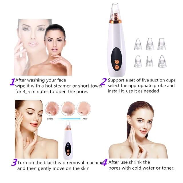 Alat Kecantikan Penghisap Komedo / Pore Remover Termurah