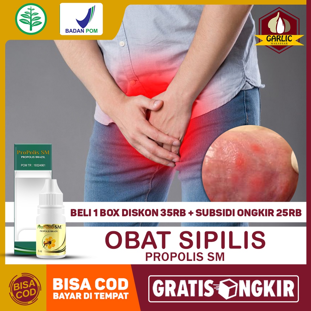 Obat Sipilis, Gonore, Kencing Nanah, Raja Singa, Penyakit Kelamin, Herpes Genital, Simpleks, Kindilo