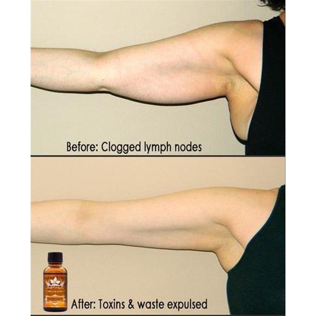 Plant Therapy Lymphatic Drainage Ginger Oil
