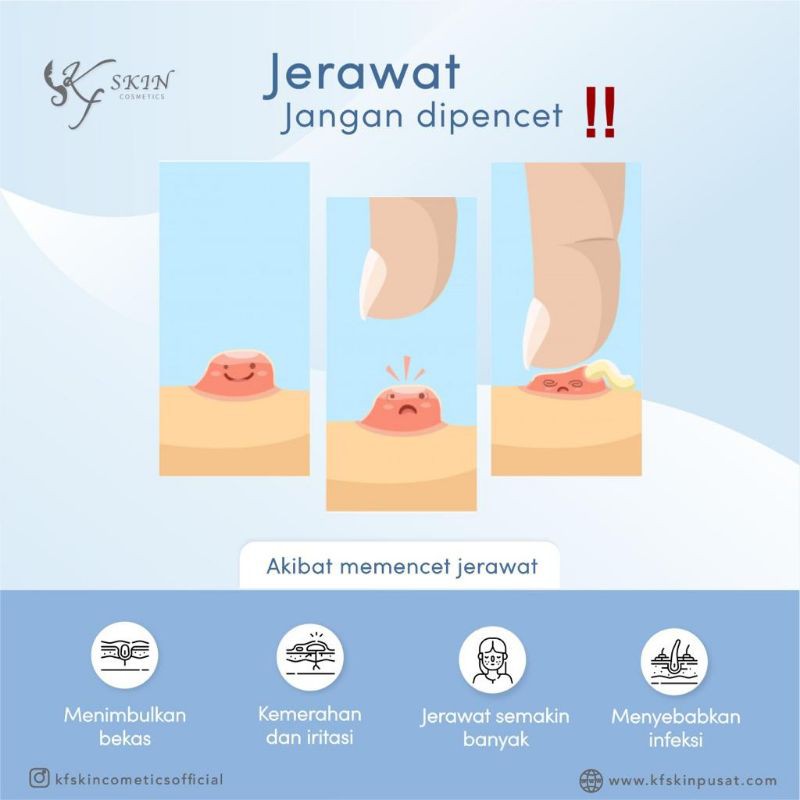 KFSKIN PAKET ACNE/PAKET ACNE KFSKIN TOSCA KFSKIN GLOWING