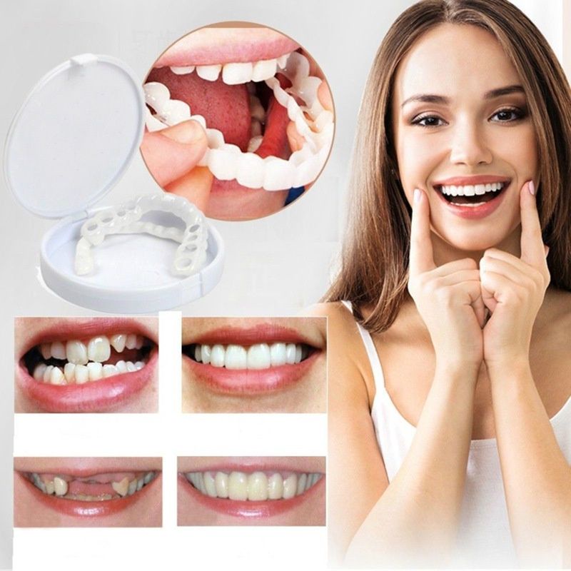 SNAP ON SMILE GIGI PALSU AUTHENTIC / GIGI PALSU SEPASANG ATAS