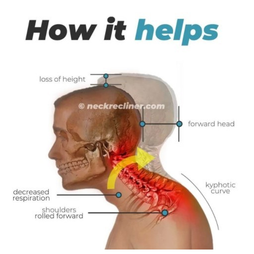 Alat Terapi Tengkuk Leher, NECKCARE, Neckpro