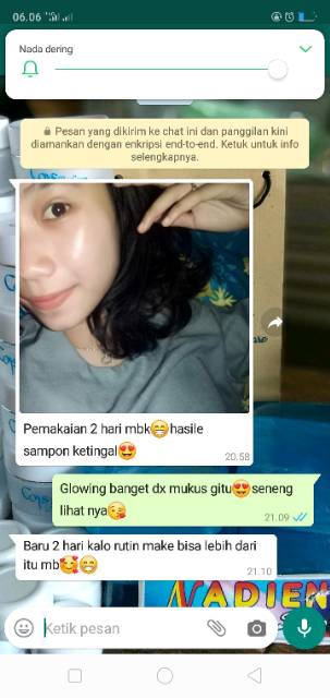 Coys skincare putih glowing dlm 7hari