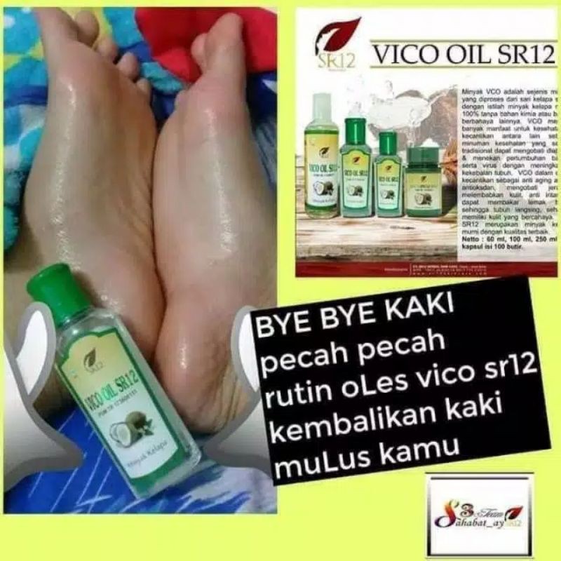 

VICO OIL SR12 100ML/250ML