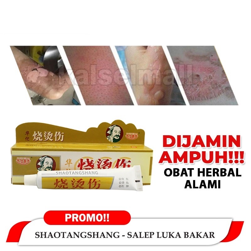 Obat Salep Krim Luka Bakar Melepuh Kutil Kunat Original 100% Huatuo Herbal Tradisional Cina Kena Air Panas Terkena Api Kulit  Menghilangkan Ampuh Keloid OC7