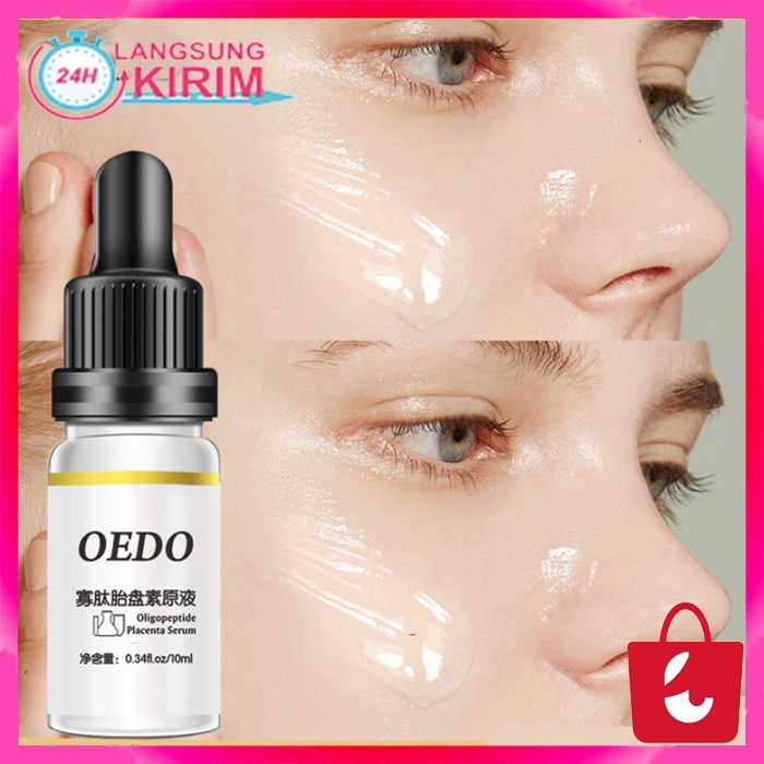 [Terbukt Alami] OEDO Oligopeptide Placenta Serum Wajah Perawatan Jerawat Glowing