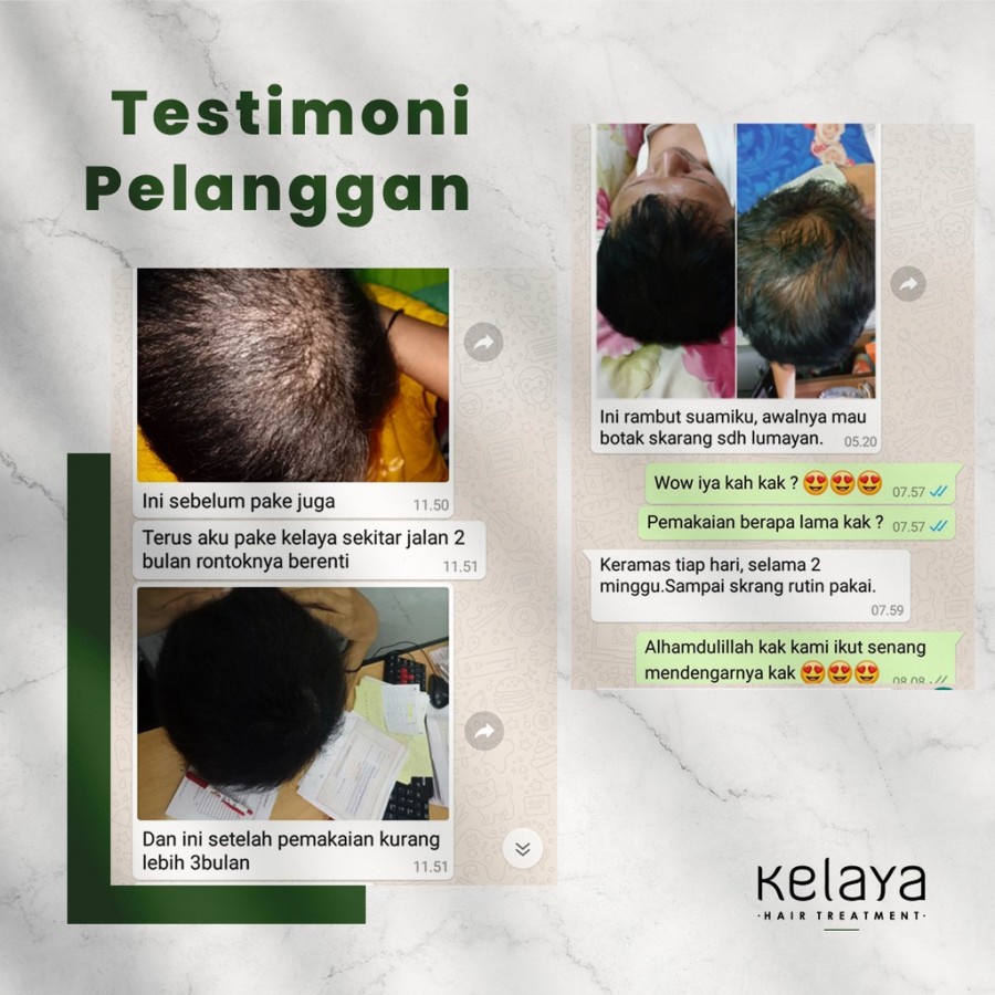 ( PROMO ) BISA COD - KELAYA HAIR TREATMENT SHAMPOO PENGHITAM RAMBUT DAN RONTOK